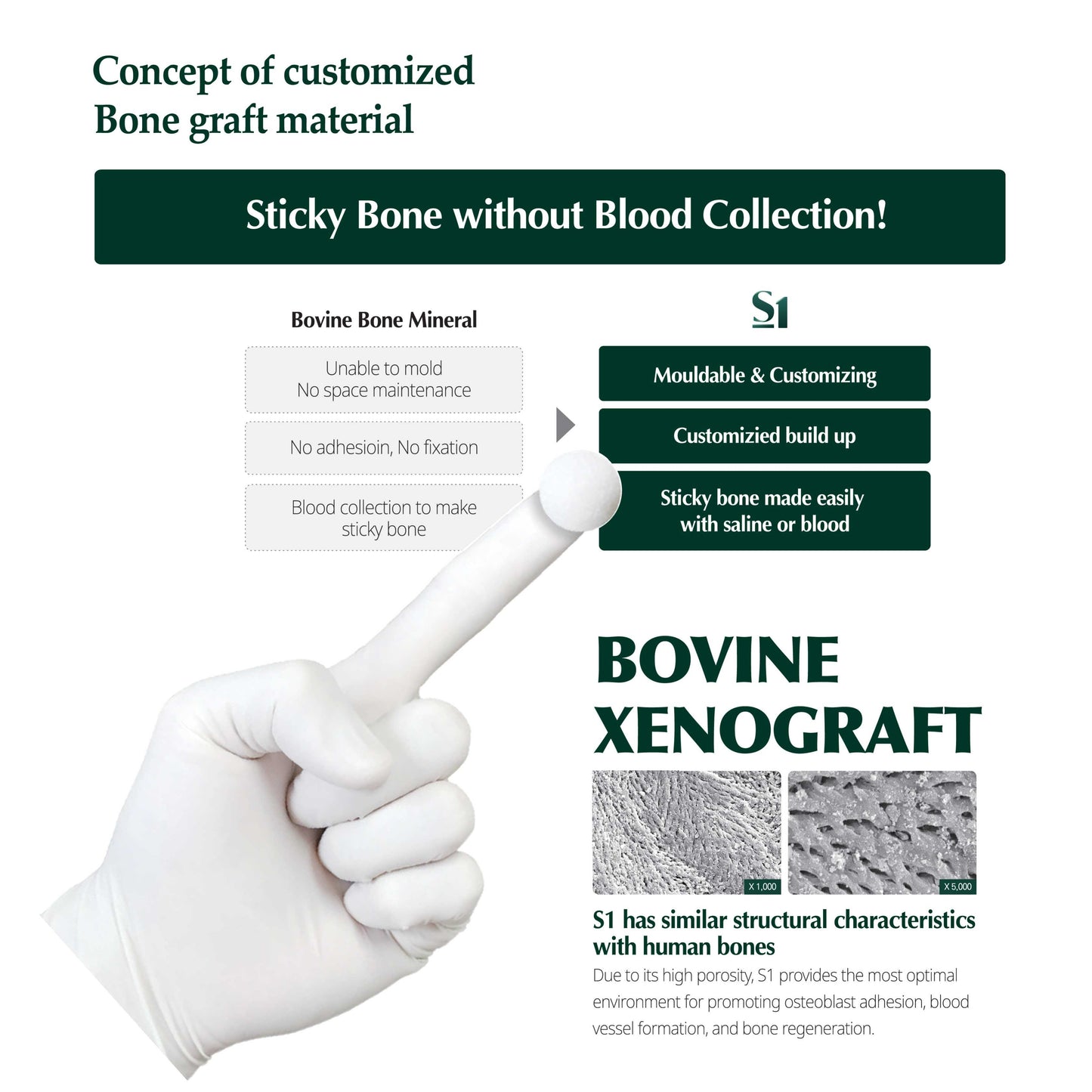 S1-Bovine Sticky and Moldable Xenograft Bone 