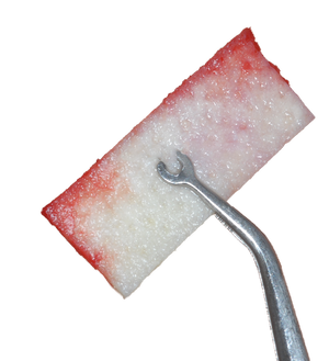 GingiDerm Acellular Dermis