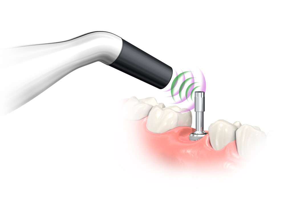Penguin Rfa Penguin RFA – DoWell Dental Products, Inc.