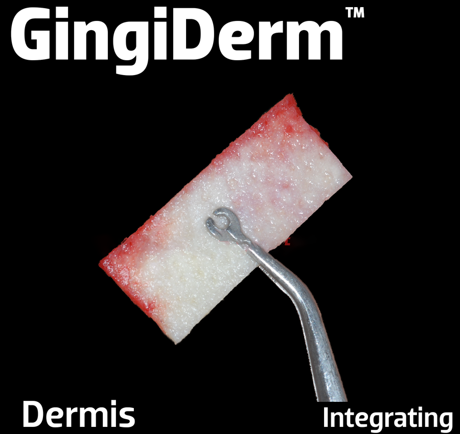 GingiDerm Acellular Dermis