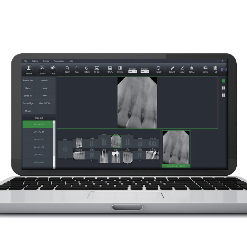 laptop and screen showing Digital Intraoral Image Sensor