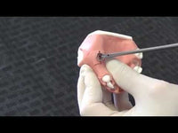 Video of Tissue Flap Punch