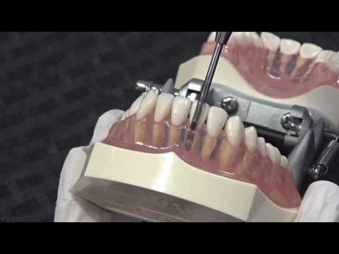 A demo of Flexible Periotome - Curved loosening lower tooth