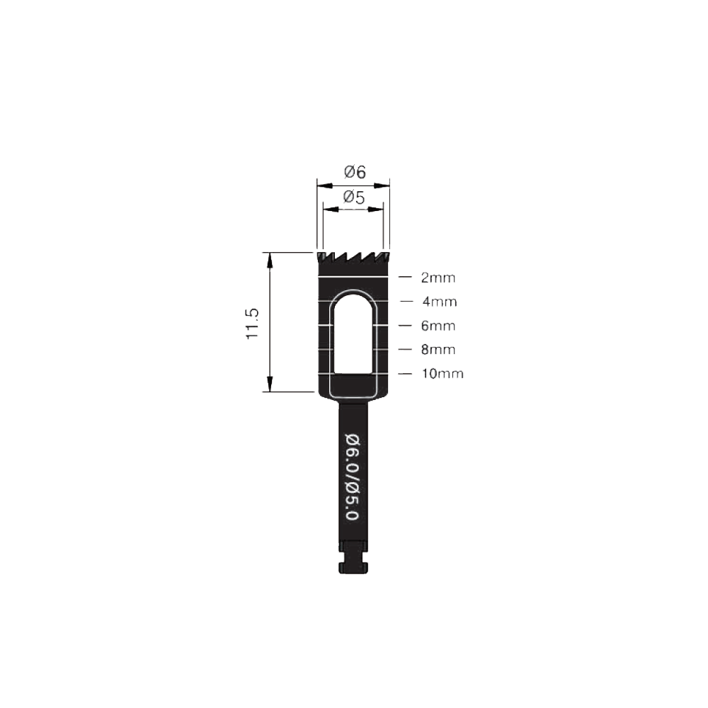 Trephine Bur 6.0/5.0mm